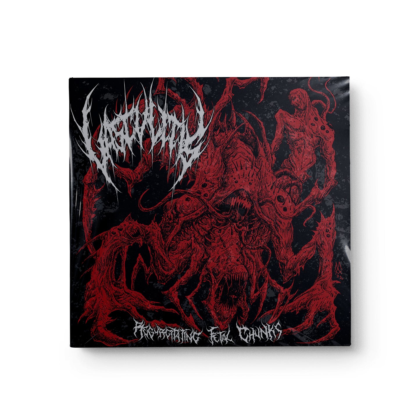 Vasculitis "Regurgitating Fetal Chunks" CD